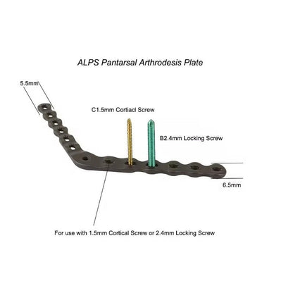 ALPS Pantarsal Arthrodesis Plate