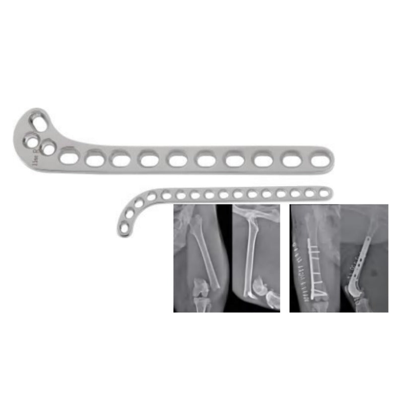 2.0/2.4/2.7/3.5mm Supracondylar Plate