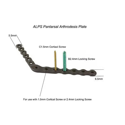 ALPS Pantarsal Arthrodesis Plate